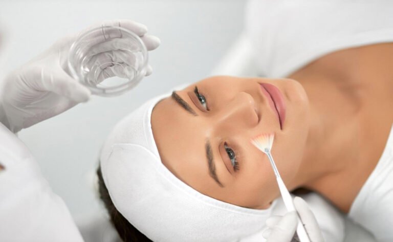 chemical peels