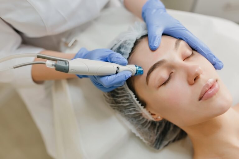 Microneedling at home